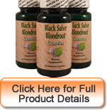 Black Salve Bloodroot Capsules (3)